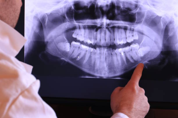 Teeth Whitening in OH