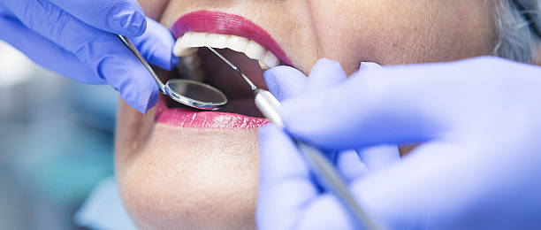 Best Knocked-Out Tooth Emergency  in Oxford, OH